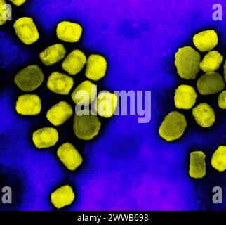 Micrographie électronique à transmission colorée des particules de virus de la variole du singe (jaune) cultivées et purifiées à partir de cultures cellulaires. Banque D'Images