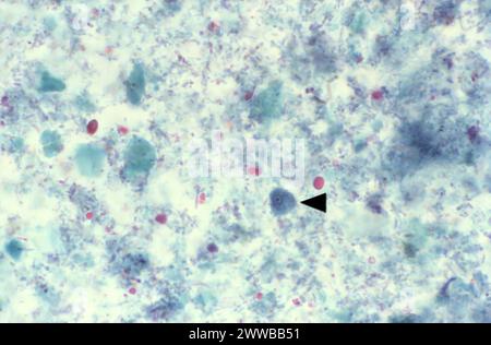 Cette photomicrographie d'un spécimen coloré au trichrome a révélé la présence d'un trophozoïte Entamoeba hartmanni (flèche). E. Banque D'Images