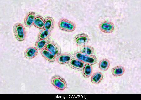 Pneumocoque (Streptococcus pneumoniae), le pneumocoque est une bactérie impliquée dans la pneumonie, la bronchopneumonie, la pleurésie purulente, la méningite bactérienne. Banque D'Images