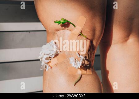 Fleurs collées avec un bandage sur la cicatrice de la jambe de la femme Banque D'Images