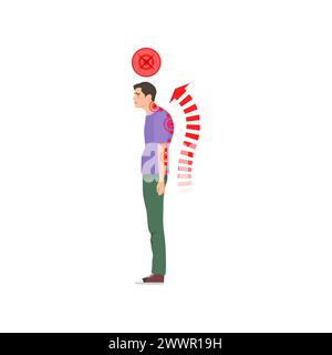 Homme debout avec une posture de colonne vertébrale incorrecte. Santé de la colonne vertébrale, mauvaise pose du corps illustration vectorielle de dessin animé Illustration de Vecteur