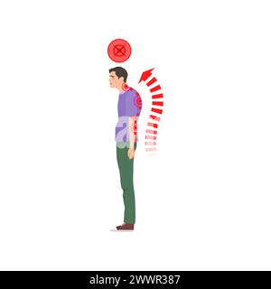 Homme debout avec une posture de colonne vertébrale incorrecte. Santé de la colonne vertébrale, mauvaise pose du corps illustration vectorielle de dessin animé Illustration de Vecteur