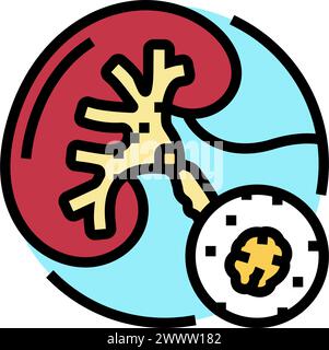 illustration vectorielle d'icône de couleur d'urologie urolithiase Illustration de Vecteur