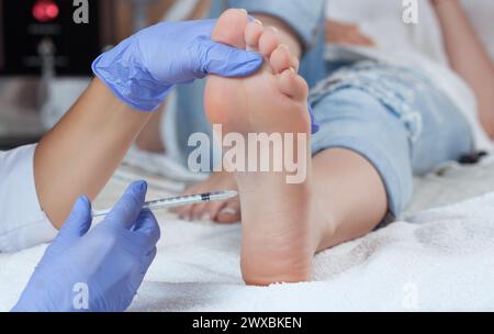 Le médecin fait des injections intramusculaires de toxinum botulique sur les pieds d'une femme contre l'hyperhidrose. Banque D'Images