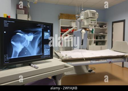 Radiographie de l'épaule, service de radiologie, hôpital Donostia, Saint-Sébastien, Donostia, Gipuzkoa, pays Basque, Espagne. Banque D'Images