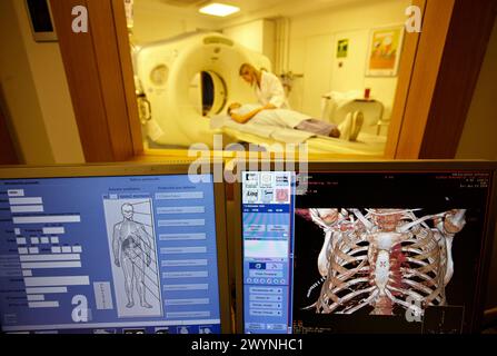 Aorte, cage thoracique, tomographie axiale informatisée (CAT), radiologie, imagerie médicale pour diagnostic. Hôpital Policlinica Gipuzkoa, Saint-Sébastien, Donostia, Euskadi, Espagne. Banque D'Images