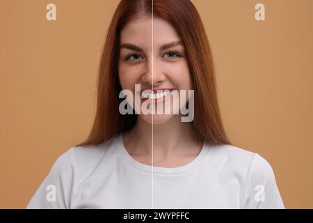 Femme avec des taches de rousseur et une peau claire sur fond beige foncé, collage Banque D'Images