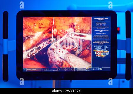 Ecran avec image interne d'une intervention chirurgicale, traitement chirurgical du cancer de la prostate, prostatectomie radicale, robot chirurgical Da Vinci, Urologie, chirurgie, salle d'opération, Hôpital Onkologikoa, Institut d'oncologie, Centre de cas pour la prévention, le diagnostic et le traitement du cancer, Donostia, Saint-Sébastien, Gipuzkoa, pays Basque, Espagne, Europe. Banque D'Images
