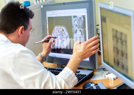 IMRT, radiothérapie avec modulation d'intensité, planification du traitement de radiothérapie 3D du cancer de l'abdomen, radiothérapie, Hôpital Donostia, Saint-Sébastien, Gipuzkoa, pays basque, Espagne. Banque D'Images