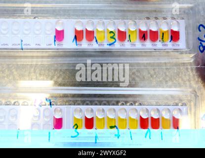 Test de microbiologie API, identification des bactéries technicien de laboratoire effectuant un test API d'index de profil analytique cette méthode est utilisée pour identifier les bactéries en fonction des réactions biochimiques entre les bactéries et divers produits chimiques placés dans les puits API cela produit un motif de changements de couleur sur la bande API qui est une signature pour cette espèce particulière de bactérie, laboratoire d'analyse, Hôpital Onkologikoa, Institut d'oncologie, Centre de cas pour la prévention, le diagnostic et le traitement du cancer, Donostia, Saint-Sébastien, Gipuzkoa, pays Basque, Espagne. Banque D'Images