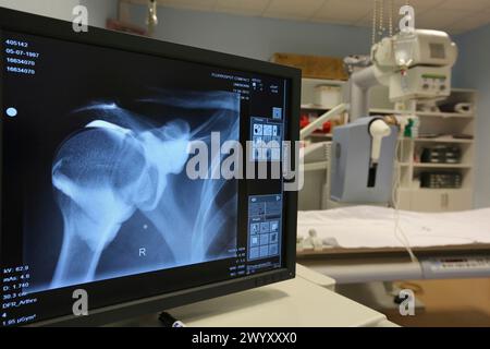 Radiographie de l'épaule, service de radiologie, hôpital Donostia, Saint-Sébastien, Donostia, Gipuzkoa, pays Basque, Espagne. Banque D'Images