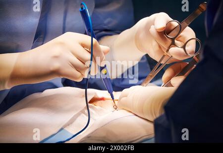 Chirurgie générale, salle d'opération, chirurgie ambulatoire, Hôpital Donostia, Saint-Sébastien, Gipuzkoa, pays Basque, Espagne. Banque D'Images