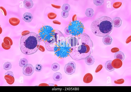 CAR T thérapie de cellules dans le myélome multiple (MM) - vue isométrique illustration 3D. Banque D'Images