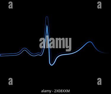 Illustration vectorielle isolée de l'électrocardiogramme avec effet néon. Illustration de Vecteur