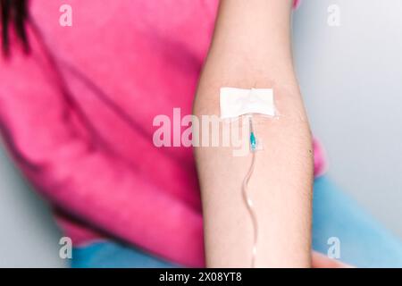 Une vue rapprochée du bras d'un patient avec une ligne intraveineuse bien placée, le ruban adhésif assurant un mouvement minimal pour un administ de médicament approprié Banque D'Images