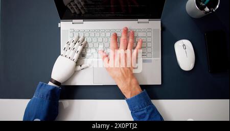 Homme avec prothèse de main travaillant sur ordinateur portable. Membre artificiel Banque D'Images