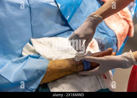 L'infirmière ferme l'accès vasculaire du patient après la chirurgie. Une infirmière applique des bandages vasculaires dans la salle d'opération. Traitement médical à garder Banque D'Images