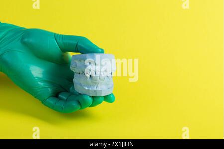 La main du médecin dans un gant médical vert tient un plâtre bleu de la mâchoire anatomique du patient. Le concept de l'empreinte maxillaire pour denta Banque D'Images