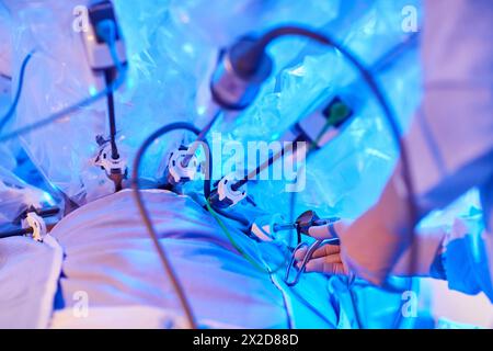 Traitement chirurgical du cancer de la prostate, prostatectomie radicale, robot chirurgical Da Vinci, équipe de chirurgiens des docteurs Madina & Azparren, Urologie, chirurgie Banque D'Images