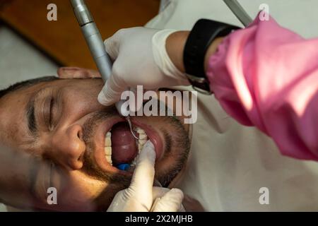 L'homme adulte latin subit une procédure de nettoyage des dents ultrasonique machine pour enlever le calcul dentaire de ses dents. Banque D'Images