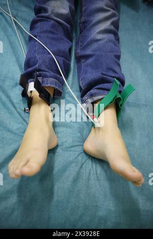 Jambes de garçon adolescent avec électrodes pour enregistrement d'électrocardiogramme au lit à l'hôpital Banque D'Images