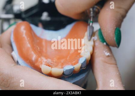 Le dentiste fraise à main les couronnes dentaires. Technicien dentaire travaillant avec des couronnes céramiques en laboratoire dentaire Banque D'Images