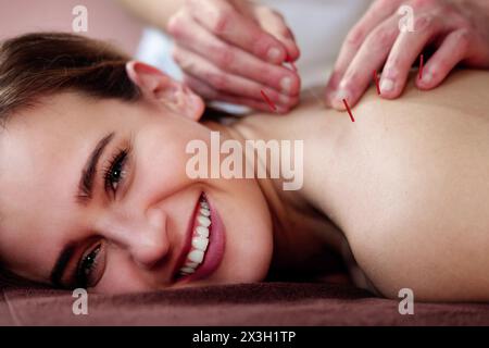 Thérapie d'acupuncture : soin de ventouse et de massage avec aiguilles sèches Banque D'Images