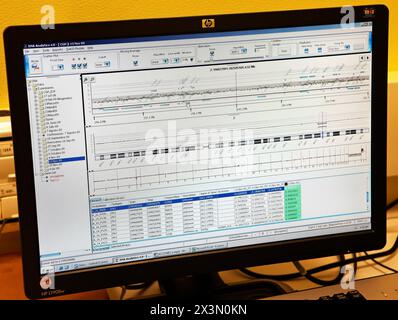 Analyse de 105 000 morceaux d'ADN humain, diagnostic prénatal par Array CGH (comparative Genomic hybridization), Cytogénétique. Hôpital Policlinica GI Banque D'Images
