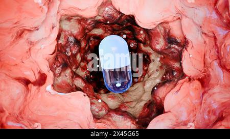 Les probiotiques dans le tractus intestinal. endoscopie par l'intestin. Microbiote, pilule capsule avec des vitamines pour le système digestif, traitement des douleurs d'estomac, rouge Banque D'Images