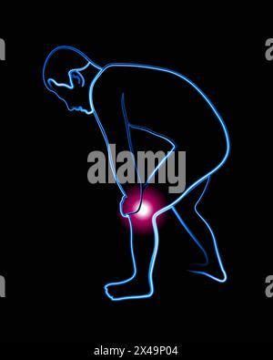 Illustration isolée vectorielle d'une silhouette d'une personne souffrant de douleur dans l'articulation du genou. Illustration de Vecteur
