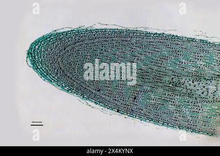 cellules d'oignon sous microscope optique à 10 fois grossissement Banque D'Images