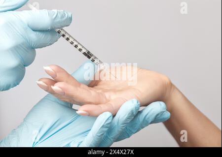 Le médecin fait des injections de toxine botulique sur les paumes d'une femme contre l'hyperhidrose. Cosmétologie féminine, soins de la peau. Banque D'Images