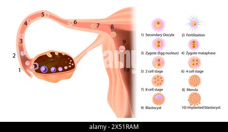 Étapes du parcours d'un oeuf fécondé humain, de l'ovulation et du mouvement dans la trompe de Fallope à l'implantation dans l'utérus. Illustration de Vecteur