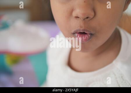 gros plan de la lèvre sèche d'un enfant Banque D'Images
