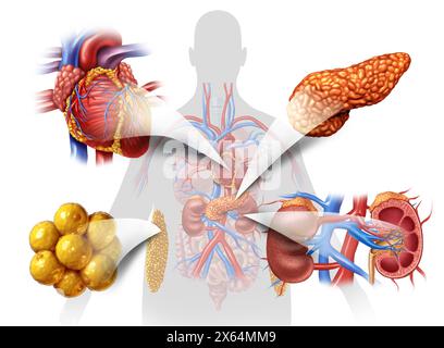 Syndrome métabolique cardiovasculaire du rein comme un trouble multisystémique comme maladie liée à un groupe d'organes comme les reins coeur pancréas et les cellules adipeuses Banque D'Images