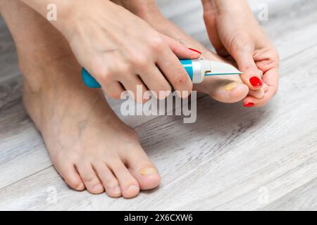 femme ponçant ses ongles d'orteils avec une ponceuse. mycose des ongles. maladie de l'ongle de pied. femme prenant soin des ongles des orteils. ongle jaune. meuleuse d'ongles électrique Banque D'Images