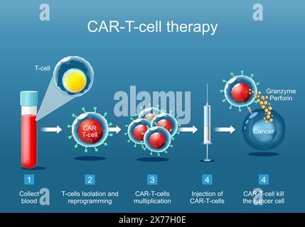 CAR T-thérapie. immunothérapie anticancéreuse. destruction des cellules tumorales. génétiquement modifié. Médecine personnalisée. Affiche vectorielle. Isométrique plat illust Illustration de Vecteur