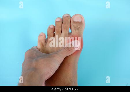 Gros plan de l'homme avec douleur à la jambe, homme souffrant de douleur à la jambe, blessure de goutte, douleur articulaire. concept de podologie Banque D'Images