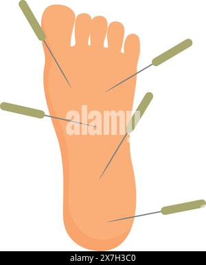 Illustration vectorielle de la thérapie d'acupuncture pour le soulagement de la douleur des pieds et le bien-être, incorporant la médecine traditionnelle chinoise et les pratiques de guérison alternatives Illustration de Vecteur