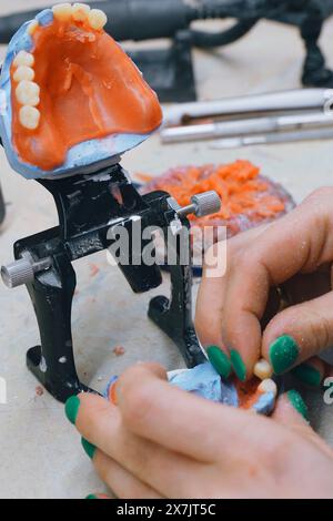 Les mains d'un technicien dentaire orthodontique fabriquent une prothèse dentaire en travaillant avec de la cire liquide fondue. Gros plan Banque D'Images