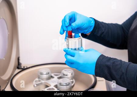 Expertise placer des échantillons de sang dans des flacons sur une centrifugeuse dans une clinique de beauté pour le traitement de la calvitie Banque D'Images