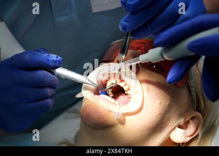 Dentiste avec assistant sous microscope traite les dents du patient. La dentisterie moderne progressive. Nettoyage professionnel des dents Banque D'Images