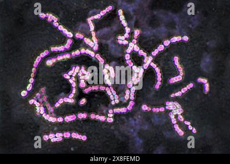 Streptocoques pyogenes du groupe A. Elle est la cause d'infections cutanées impétigo, abcès, infections bronchopulmonaires, une forme de mal de gorge qui peut se développer en complications telles que le rhumatisme articulaire aigu. Image produite par microscopie optique. Streptocoques 016813 050 Banque D'Images