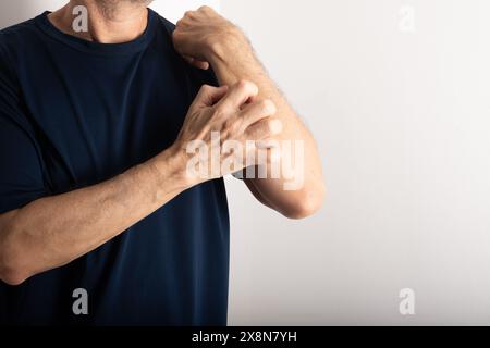 Homme d'âge moyen se grattant l'avant-bras. Maladie de la peau. Soins dermatologiques Banque D'Images