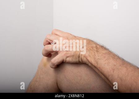 Homme grattant entre le genou et la jambe. Maladie de la peau. Réaction allergique. Dermatologie. Isolé sur fond blanc. Banque D'Images