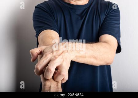 Homme d'âge moyen se grattant l'avant-bras. Maladie de la peau. Soins dermatologiques Banque D'Images