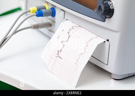 Gros plan de l'appareil électrocardiotocographique ou moniteur fœtal électronique (EFM) enregistrant le rythme cardiaque fœtal et les contractions utérines pendant le fina Banque D'Images