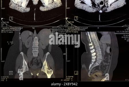 Tomodensitométrie magnétique photo de la femme Banque D'Images