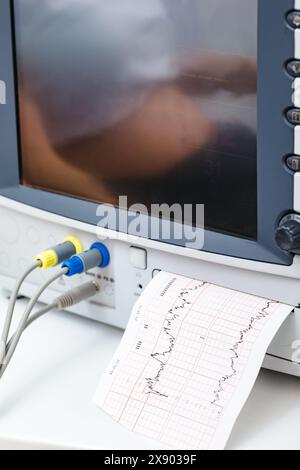 Gros plan de l'appareil électrocardiotocographique ou moniteur fœtal électronique (EFM) enregistrant le rythme cardiaque fœtal et les contractions utérines pendant le fina Banque D'Images