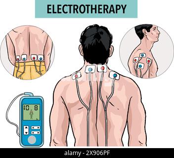 Services de physiothérapie. Soulagement des douleurs dorsales. Réadaptation des traumatismes. L'électrothérapie. Aide clinique. Illustration vectorielle isolée illustration stock. Illustration de Vecteur